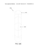 NON-PLANAR ORTHOPEDIC IMPLANTS AND METHODS diagram and image