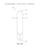 NON-PLANAR ORTHOPEDIC IMPLANTS AND METHODS diagram and image