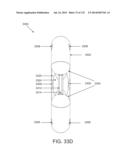 NON-PLANAR ORTHOPEDIC IMPLANTS AND METHODS diagram and image