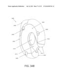 NON-PLANAR ORTHOPEDIC IMPLANTS AND METHODS diagram and image