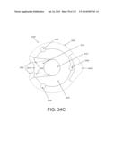 NON-PLANAR ORTHOPEDIC IMPLANTS AND METHODS diagram and image