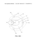 NON-PLANAR ORTHOPEDIC IMPLANTS AND METHODS diagram and image