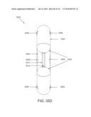 NON-PLANAR ORTHOPEDIC IMPLANTS AND METHODS diagram and image