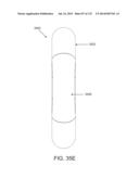 NON-PLANAR ORTHOPEDIC IMPLANTS AND METHODS diagram and image