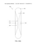 NON-PLANAR ORTHOPEDIC IMPLANTS AND METHODS diagram and image