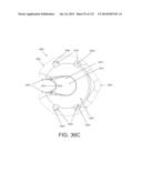 NON-PLANAR ORTHOPEDIC IMPLANTS AND METHODS diagram and image