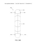 NON-PLANAR ORTHOPEDIC IMPLANTS AND METHODS diagram and image