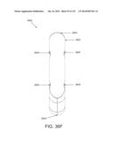 NON-PLANAR ORTHOPEDIC IMPLANTS AND METHODS diagram and image