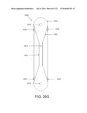 NON-PLANAR ORTHOPEDIC IMPLANTS AND METHODS diagram and image