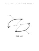 NON-PLANAR ORTHOPEDIC IMPLANTS AND METHODS diagram and image