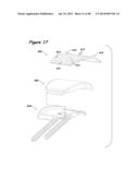 Joint Arthroplasty Systems, Methods, and Components diagram and image