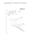 Joint Arthroplasty Systems, Methods, and Components diagram and image