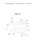 Joint Arthroplasty Systems, Methods, and Components diagram and image