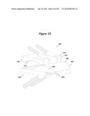 Joint Arthroplasty Systems, Methods, and Components diagram and image