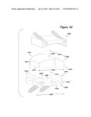 Joint Arthroplasty Systems, Methods, and Components diagram and image