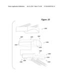 Joint Arthroplasty Systems, Methods, and Components diagram and image