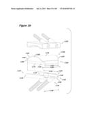 Joint Arthroplasty Systems, Methods, and Components diagram and image