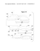 Joint Arthroplasty Systems, Methods, and Components diagram and image