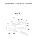 Joint Arthroplasty Systems, Methods, and Components diagram and image