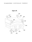 Joint Arthroplasty Systems, Methods, and Components diagram and image