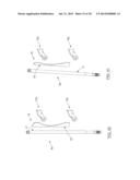 ANCHORING SYSTEM diagram and image