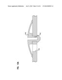 GAS/LIQUID SEPARATOR AND COMPONENTS; LIQUID DRAIN FLOW ASSEMBLIES; SYSTEMS     OF USE ; AND, FEATURES; AND, COMPONENTS diagram and image