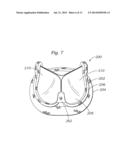 METHODS OF MAKING ENCAPSULATED HEART VALVES diagram and image