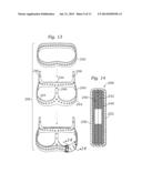 METHODS OF MAKING ENCAPSULATED HEART VALVES diagram and image