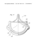 METHODS OF MAKING ENCAPSULATED HEART VALVES diagram and image