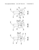 SWITCH ASSEMBLY AND OVER-STEER DETECTION SYSTEM diagram and image