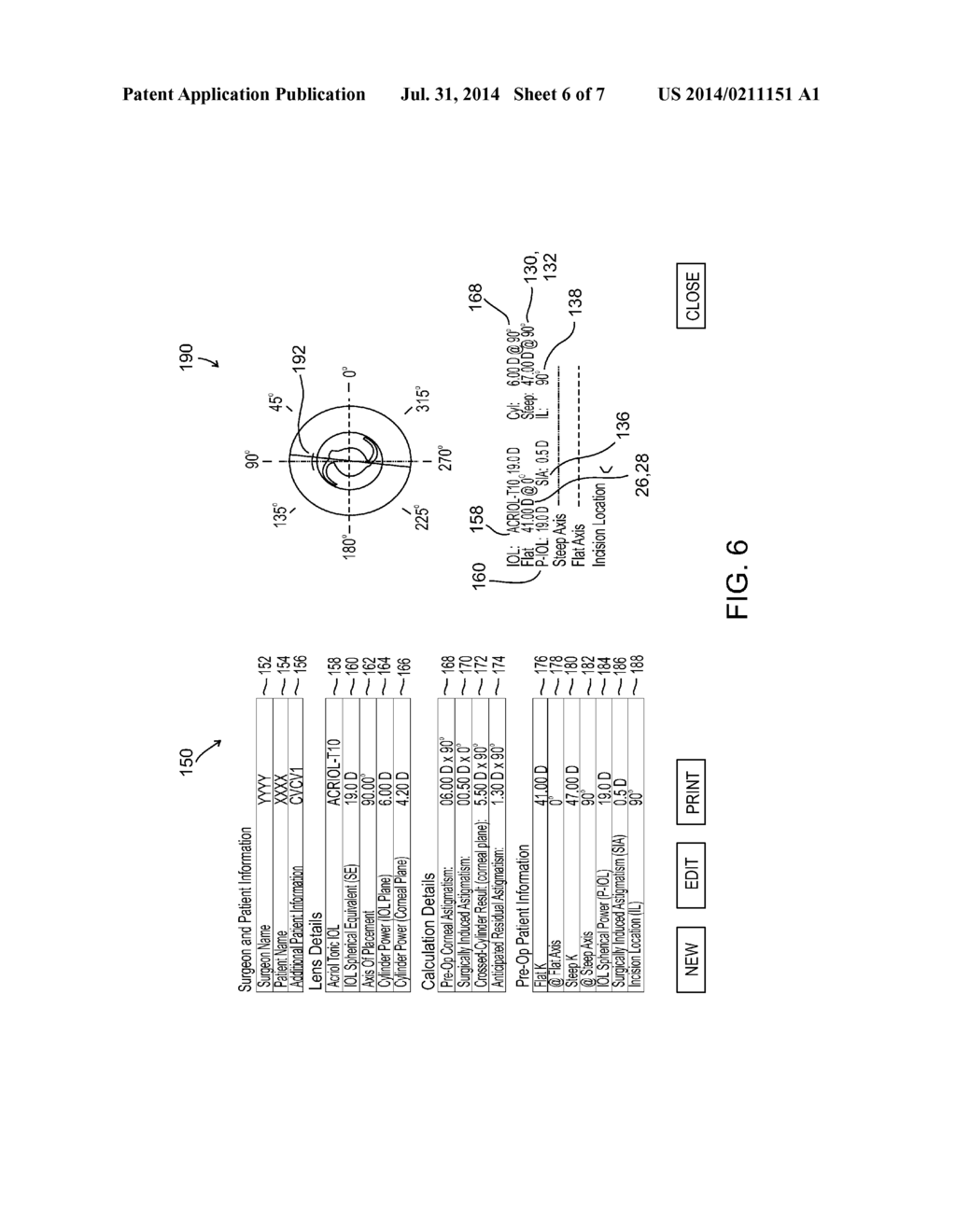 TORIC LENS CALCULATOR - diagram, schematic, and image 07