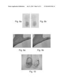 METHODS OF PRODUCING LIGNIN PEROXIDASE AND ITS USE IN SKIN AND HAIR     LIGHTENING diagram and image