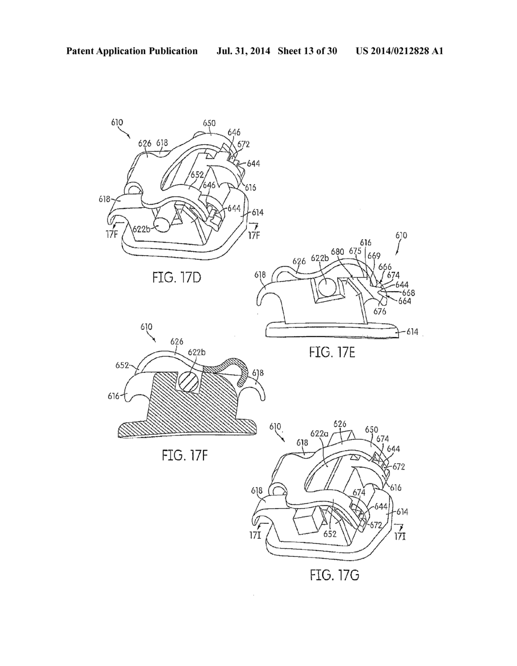 SELF-LIGATING ORTHODONTIC BRACKETS - diagram, schematic, and image 14