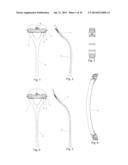 Auto-induced Tactile Feedback Device for Training Sportspersons diagram and image