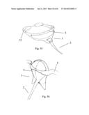 Auto-induced Tactile Feedback Device for Training Sportspersons diagram and image