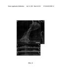 Monolayer Stress Microscopy diagram and image