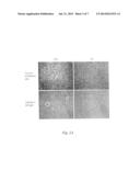 METHOD  FOR  PREPARING HUMAN  NEOPLASTICALLY  TRANSFORMED  CELLS diagram and image