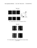 Fibrosuppressant Biotherapeutics diagram and image