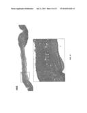 HISTONE DEACETYLASE INHIBITORS diagram and image