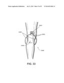 APPARATUS AND METHOD FOR ELECTROMAGNETIC TREATMENT OF NEUROLOGICAL PAIN diagram and image