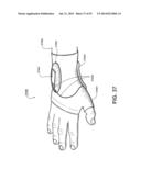 APPARATUS AND METHOD FOR ELECTROMAGNETIC TREATMENT OF NEUROLOGICAL PAIN diagram and image