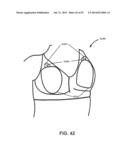 APPARATUS AND METHOD FOR ELECTROMAGNETIC TREATMENT OF NEUROLOGICAL PAIN diagram and image