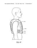 APPARATUS AND METHOD FOR ELECTROMAGNETIC TREATMENT OF NEUROLOGICAL PAIN diagram and image