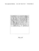 APPARATUS AND METHOD FOR ELECTROMAGNETIC TREATMENT OF NEUROLOGICAL PAIN diagram and image