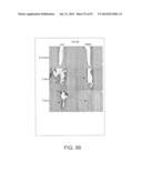 APPARATUS AND METHOD FOR ELECTROMAGNETIC TREATMENT OF NEUROLOGICAL PAIN diagram and image