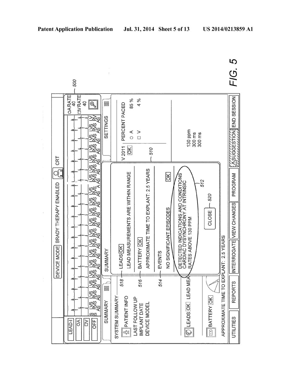 SYSTEMS AND METHODS TO IDENTIFY CARDIAC DYSYNCHRONY - diagram, schematic, and image 06