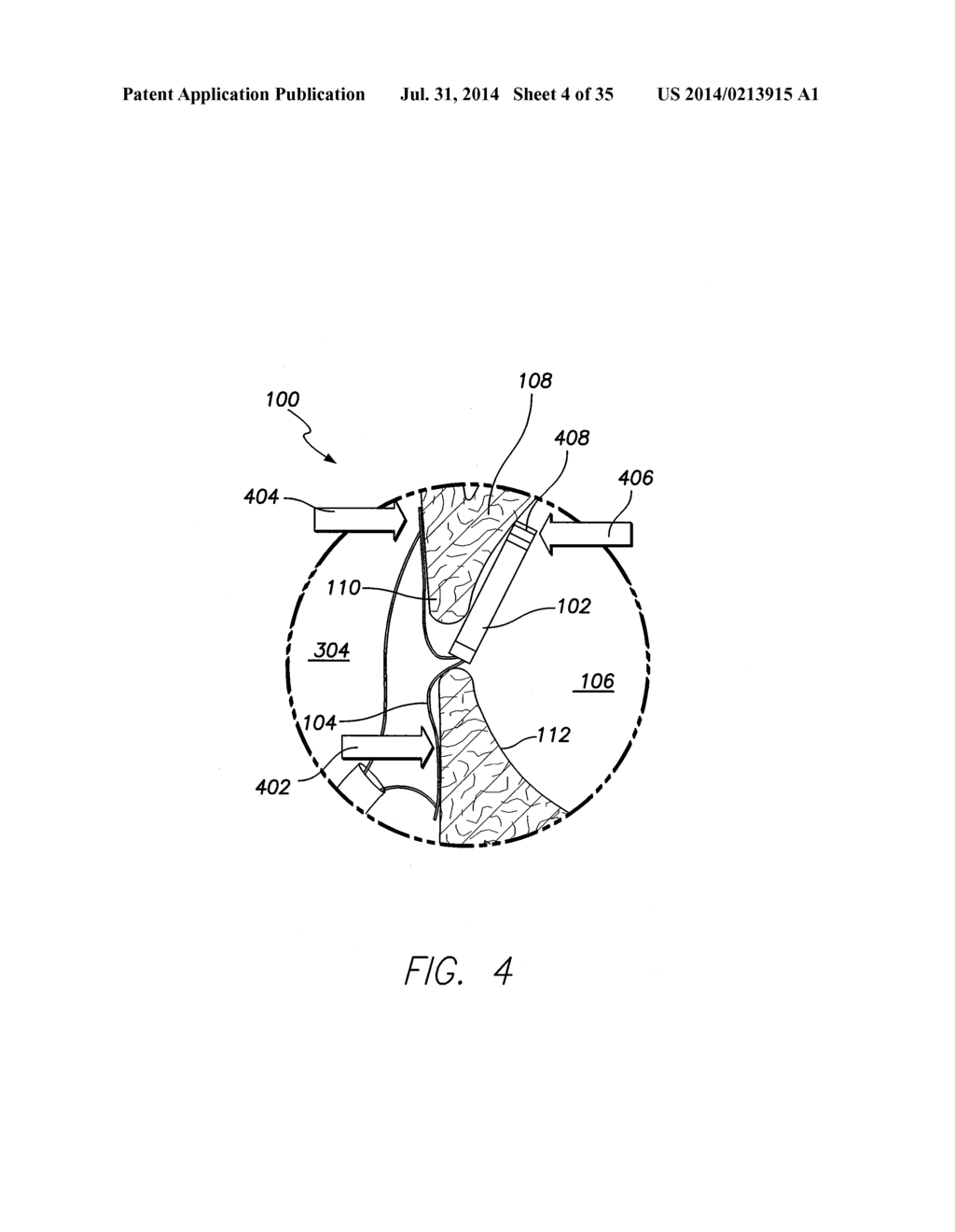 WIRELESS MEMS LEFT ATRIAL PRESSURE SENSOR - diagram, schematic, and image 05