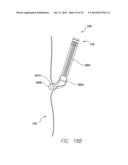 WIRELESS MEMS LEFT ATRIAL PRESSURE SENSOR diagram and image