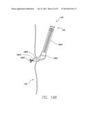 WIRELESS MEMS LEFT ATRIAL PRESSURE SENSOR diagram and image