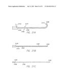 WIRELESS MEMS LEFT ATRIAL PRESSURE SENSOR diagram and image